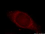 KIAA0528 Antibody in Immunocytochemistry (ICC/IF)