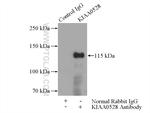 KIAA0528 Antibody in Immunoprecipitation (IP)