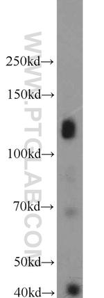 KIAA0528 Antibody in Western Blot (WB)