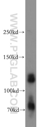 KIAA0528 Antibody in Western Blot (WB)