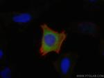 LARS Antibody in Immunocytochemistry (ICC/IF)