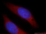 LARS Antibody in Immunocytochemistry (ICC/IF)