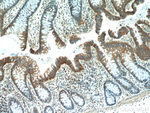 LARS Antibody in Immunohistochemistry (Paraffin) (IHC (P))