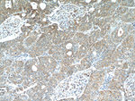 LARS Antibody in Immunohistochemistry (Paraffin) (IHC (P))