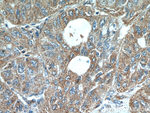 LARS Antibody in Immunohistochemistry (Paraffin) (IHC (P))