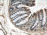 LARS Antibody in Immunohistochemistry (Paraffin) (IHC (P))