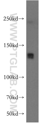 LARS Antibody in Western Blot (WB)