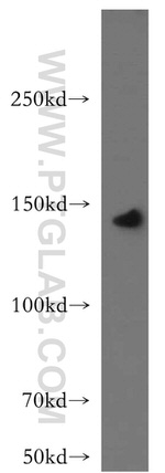 LARS Antibody in Western Blot (WB)