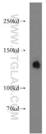 LARS Antibody in Western Blot (WB)