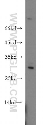 UPK2 Antibody in Western Blot (WB)