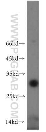 UPK2 Antibody in Western Blot (WB)