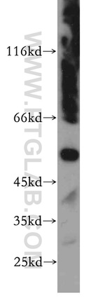 LILRA4 Antibody in Western Blot (WB)