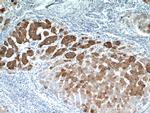 ELOVL6 Antibody in Immunohistochemistry (Paraffin) (IHC (P))