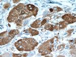 ELOVL6 Antibody in Immunohistochemistry (Paraffin) (IHC (P))