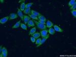 SH3BGR Antibody in Immunocytochemistry (ICC/IF)