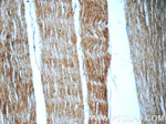 SH3BGR Antibody in Immunohistochemistry (Paraffin) (IHC (P))