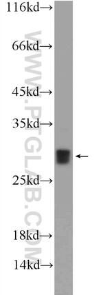 SH3BGR Antibody in Western Blot (WB)