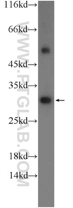 SH3BGR Antibody in Western Blot (WB)