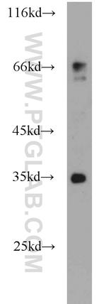 HTR4 Antibody in Western Blot (WB)