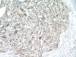 MKL1 Antibody in Immunohistochemistry (Paraffin) (IHC (P))