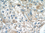 MKL1 Antibody in Immunohistochemistry (Paraffin) (IHC (P))