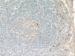 MKL1 Antibody in Immunohistochemistry (Paraffin) (IHC (P))