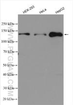 MKL1 Antibody in Western Blot (WB)