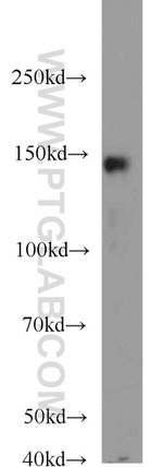 MKL1 Antibody in Western Blot (WB)