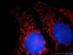 LRPPRC Antibody in Immunocytochemistry (ICC/IF)