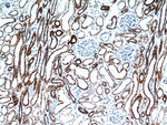 LRPPRC Antibody in Immunohistochemistry (Paraffin) (IHC (P))