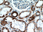 LRPPRC Antibody in Immunohistochemistry (Paraffin) (IHC (P))