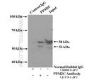 PPM2C Antibody in Immunoprecipitation (IP)