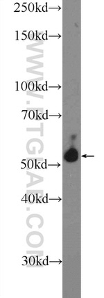 PPM2C Antibody in Western Blot (WB)