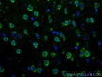 S1PR2 Antibody in Immunohistochemistry (PFA fixed) (IHC (PFA))