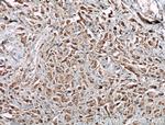 C11orf57 Antibody in Immunohistochemistry (Paraffin) (IHC (P))