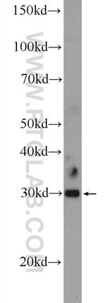 C11orf57 Antibody in Western Blot (WB)