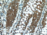 C13orf18 Antibody in Immunohistochemistry (Paraffin) (IHC (P))