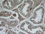 C13orf18 Antibody in Immunohistochemistry (Paraffin) (IHC (P))