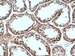 C13orf18 Antibody in Immunohistochemistry (Paraffin) (IHC (P))