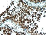 C13orf18 Antibody in Immunohistochemistry (Paraffin) (IHC (P))