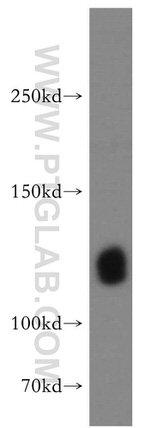 KIF5A Antibody in Western Blot (WB)