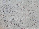 KIF5A Antibody in Immunohistochemistry (Paraffin) (IHC (P))