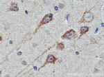 KIF5A Antibody in Immunohistochemistry (Paraffin) (IHC (P))