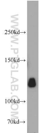 KIF5A Antibody in Western Blot (WB)