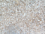 STIM2 Antibody in Immunohistochemistry (Paraffin) (IHC (P))