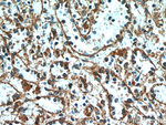 STIM2 Antibody in Immunohistochemistry (Paraffin) (IHC (P))