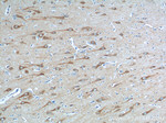 STIM2 Antibody in Immunohistochemistry (Paraffin) (IHC (P))