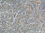 STIM2 Antibody in Immunohistochemistry (Paraffin) (IHC (P))