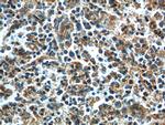 STIM2 Antibody in Immunohistochemistry (Paraffin) (IHC (P))