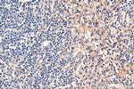 STIM2 Antibody in Immunohistochemistry (Paraffin) (IHC (P))